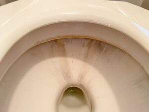 黒ずみ、黄ばみが気になる